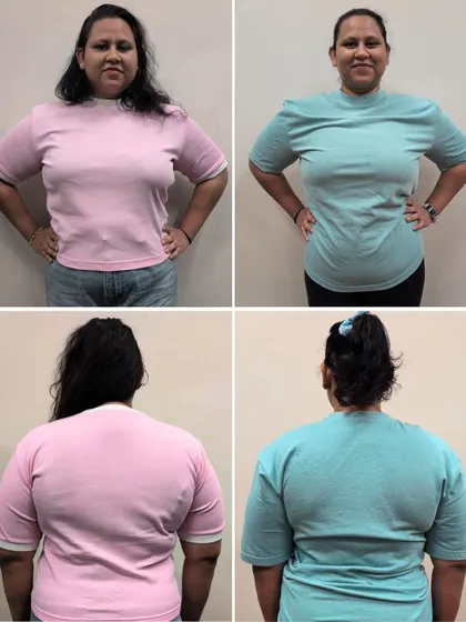 These multi-angle shots of Charini show her stronger, leaner physique, which motivated her to sign up for a full year with us.