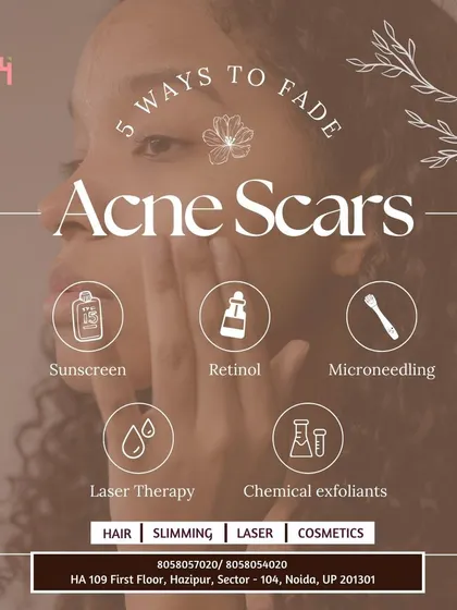 Don't let acne scars define your skin. We offer five effective pathways to fade them: consistent sunscreen use, Retinol, professional Microneedling, Laser Therapy, and chemical exfoliants. Let us create a plan for you.