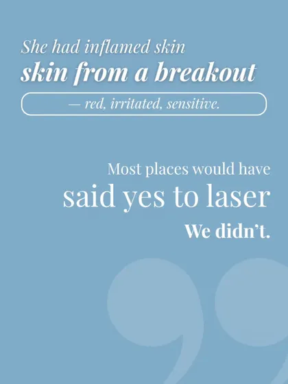 Her skin was red, irritated, and sensitive from a breakout. Most places would have said yes to laser anyway. We did not, because your skin's health comes first.
