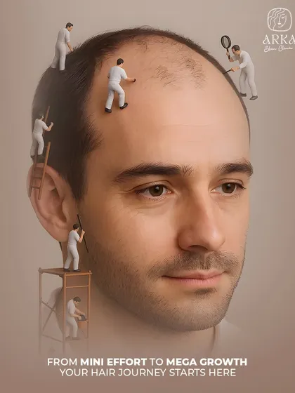 Your hair journey starts here. This creative visual represents the detailed, meticulous work our team puts into every hair transplant procedure, ensuring mega growth from a mini effort on your part.