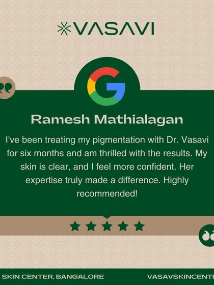 This patient sought treatment for pigmentation and was thrilled with the results after six months. My goal was to clear the skin and, in turn, boost their confidence. A consistent, expert-led plan makes all the difference in achieving an even skin tone.