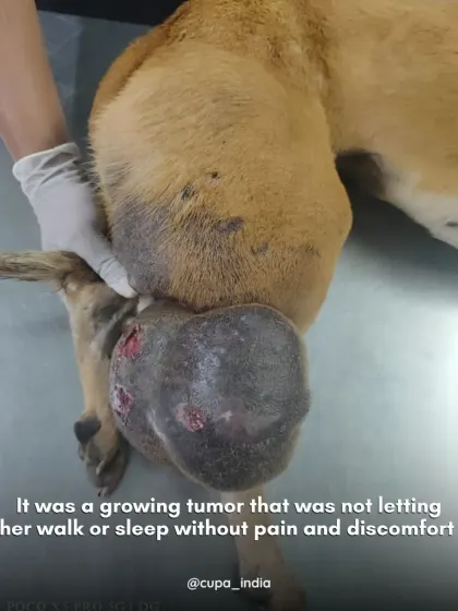 The growing tumor was causing her constant pain and discomfort, making it impossible to walk or sleep. These cases are emergencies that we prioritize.