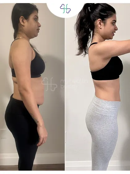 This client lost 5 kgs in 6 months, focusing first on losing stubborn belly fat and then on gaining muscle. Her journey shows the power of a phased approach.
