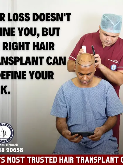 This image captures me during the critical hairline design phase. A successful transplant is not just about adding hair, it's about redefining your look with precision and artistry.