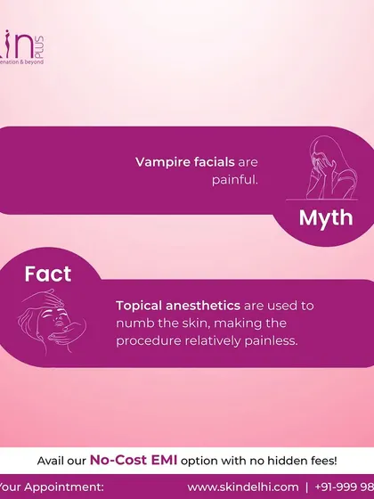 Myth vs. Fact about Vampire Facials (PRP). Many believe the treatment is painful, but the fact is we use topical anesthetics to numb the skin, making the procedure relatively painless and comfortable.