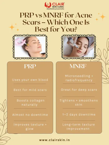 PRP vs. MNRF for acne scars. This guide helps you understand the difference. PRP is great for mild scars with no downtime, while MNRF is better for deep scars, offering significant long-term texture improvement.
