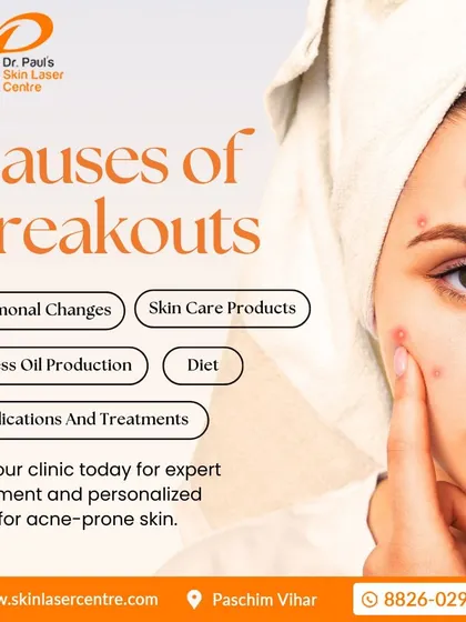A successful treatment plan starts with understanding the root cause. Breakouts can be triggered by many factors, from hormonal shifts and diet to the skincare products you use. I investigate these causes to create a plan that delivers lasting results.