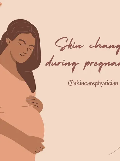 This is a summary image for the common skin changes that occur during pregnancy. It's a reminder that you are not alone in experiencing these transformations.