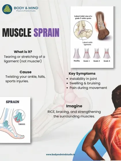 A sprain is an injury to a ligament, not a muscle, often caused by twisting a joint like the ankle.