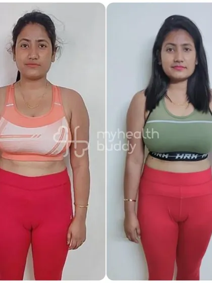 A frontal view of Sangita's 5kg weight loss. She joined with minimal expectations and was thrilled with the results from a consistent, supported routine.