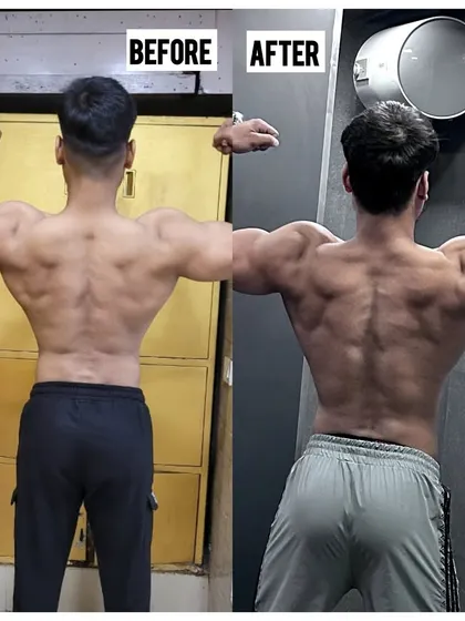 The back view of the same 6kg gain. You can see the added density and width in the lats and shoulders. We achieved this with zero unwanted fat gain or water retention, just pure muscle growth.