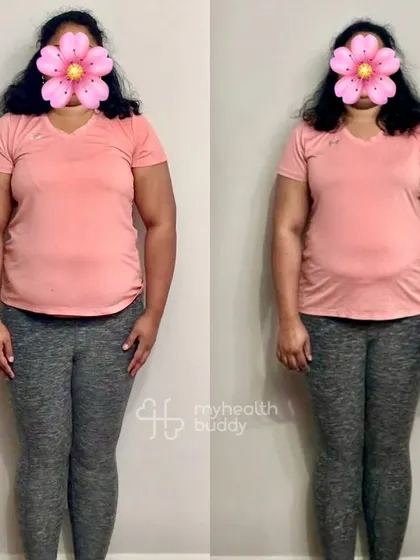 Front view of her 5 kg weight loss journey. Her story is a testament to resilience and making no excuses.