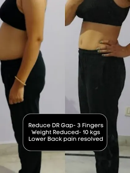 This mama resolved her lower back pain, lost 10 kgs, and reduced her DR gap by 3 fingers. This is a life-changing transformation.
