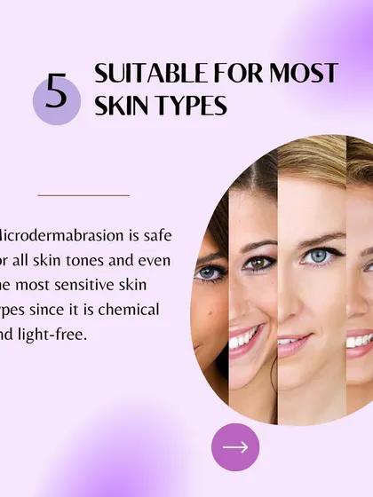 Reason 5 for Microdermabrasion: It is safe and suitable for most skin types, including sensitive skin, as it is chemical and light-free.
