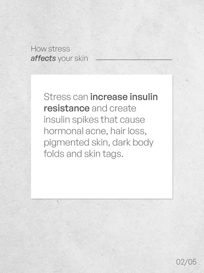 Stress can also increase insulin resistance, leading to hormonal acne, hair loss, and pigmented skin.
