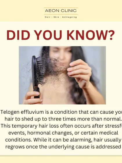 Shedding up to three times more hair than normal could be Telogen Effluvium. This temporary hair loss is often triggered by stress or hormonal changes and is usually reversible once the cause is addressed.