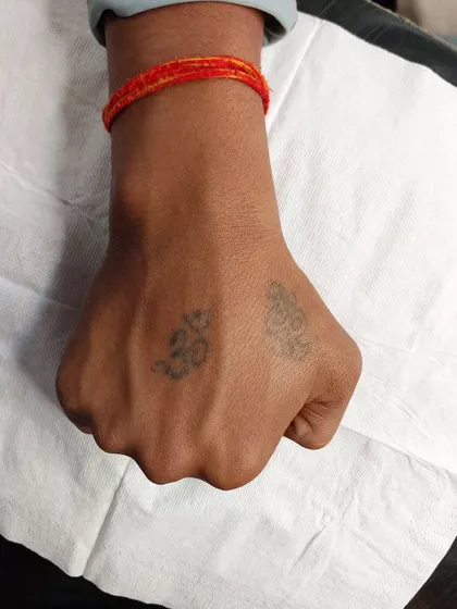Before: Two small, faded Om symbol tattoos on the back of the hand. The client wanted a stronger, more prominent design.