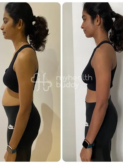 A side view of this client's 4kg weight loss. She felt much better after 3 months of training and was proud of the lifestyle changes she made.