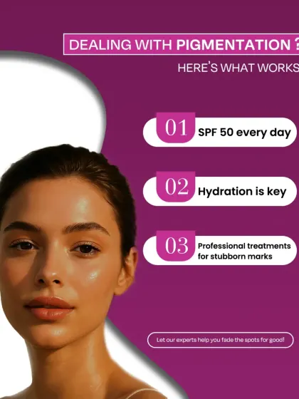 An informational graphic outlining what works for pigmentation. It recommends daily SPF 50, hydration, and professional treatments for stubborn marks.