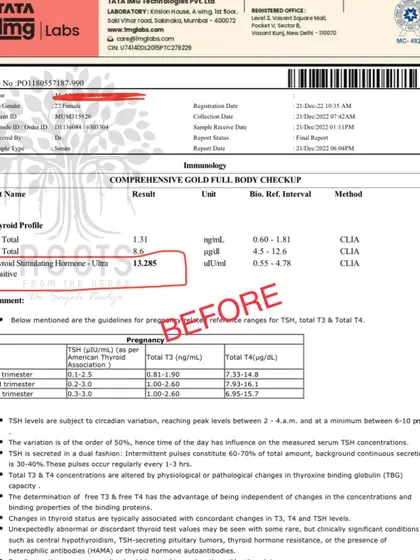 Before: This patient's report shows a highly elevated TSH level of 13.285, a clear sign of hypothyroidism that was impacting her overall health.