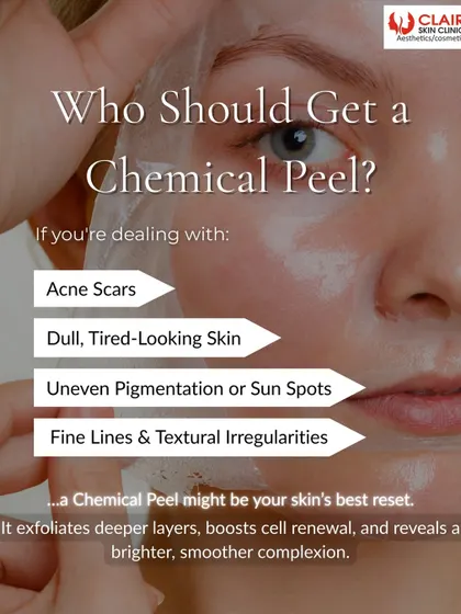 Who should get a chemical peel? If you're dealing with acne scars, dull skin, uneven pigmentation, or fine lines, a peel could be your skin's best reset. It exfoliates deeper layers and boosts cell renewal.