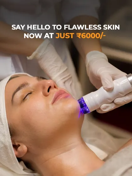 The Carbon Tri-Beam laser treatment, also known as a Hollywood Facial, in action. This procedure is excellent for minimizing pores, tightening skin, and creating a flawless finish.