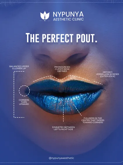 This diagram illustrates the anatomy of a perfect pout. It's not just about volume. It's about creating a defined cupid's bow, upward-turned corners, and beautiful symmetry between the left and right sides for a balanced, natural enhancement.