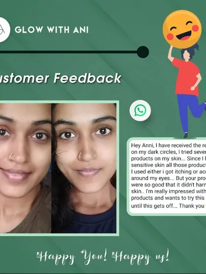 This before and after for dark circles is amazing. My customer was so happy that my products worked on her sensitive skin without causing any itching or irritation.