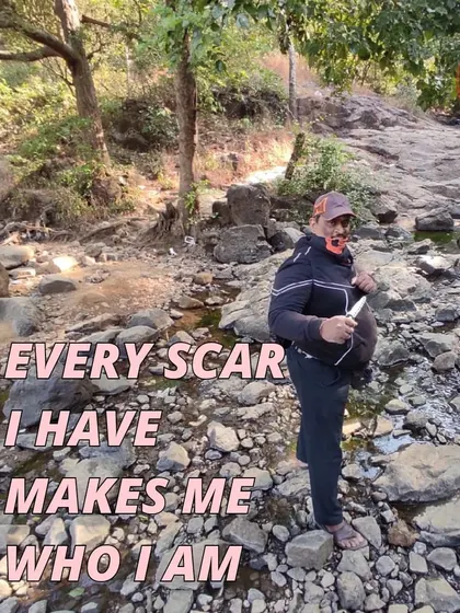 Every scar tells a story. Out in nature, training with my knife, I am reminded that my experiences make me who I am.