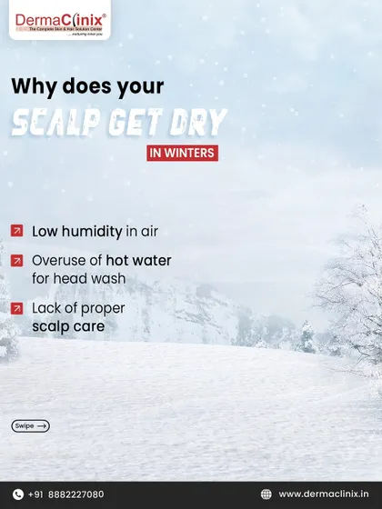 Why does your scalp get dry in winter? It's a combination of low humidity in the air, overuse of hot water for washing, and a lack of proper scalp care.