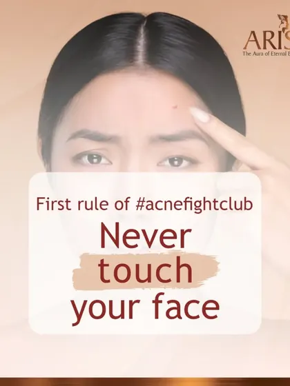 The first and most important rule of managing acne is to avoid touching your face. This prevents the spread of bacteria and reduces the risk of inflammation and scarring.