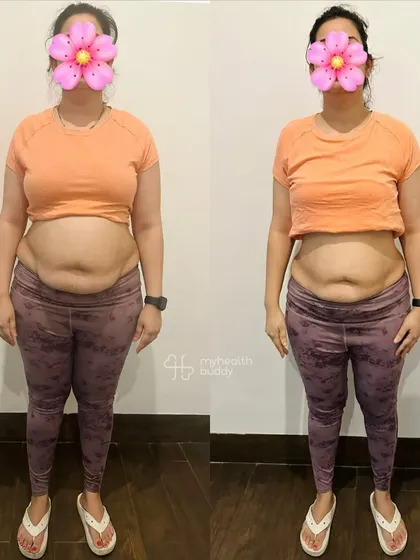 A front view of a postpartum mom's journey. Her transformation shows a visible reduction in belly fat and a stronger, more toned physique.