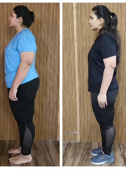 A side-view before-and-after, clearly illustrating the fat loss and improved posture.