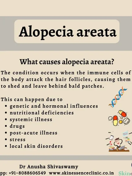 Understanding what triggers alopecia areata is important for management. This infographic lists potential causes, including genetic factors, stress, systemic illness, and nutritional deficiencies, which I evaluate during diagnosis.
