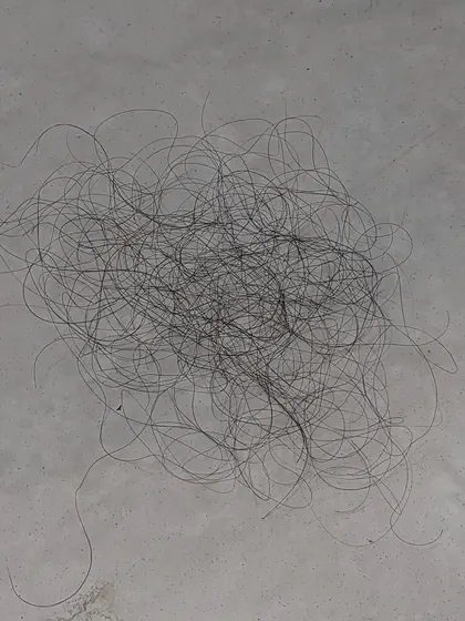 This is another visual of 100 shed hairs on a flat surface. Don't waste time on ineffective remedies if you are losing more than this; a proper diagnosis is key to an effective treatment plan.