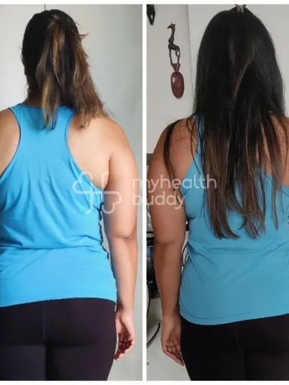 This back view shows the toning and fat loss Ishani achieved. She appreciated the patient coaching and close eye I kept on her progress.