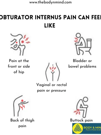 A repeat of the obturator internus pain symptoms infographic.