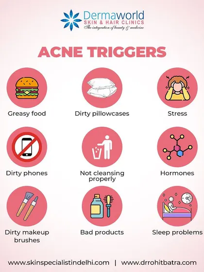 Many daily habits can trigger or worsen acne. This visual guide points out common culprits, including greasy foods, stress, hormonal fluctuations, and even a dirty phone screen. Identifying your personal triggers is a key part of managing your skin.