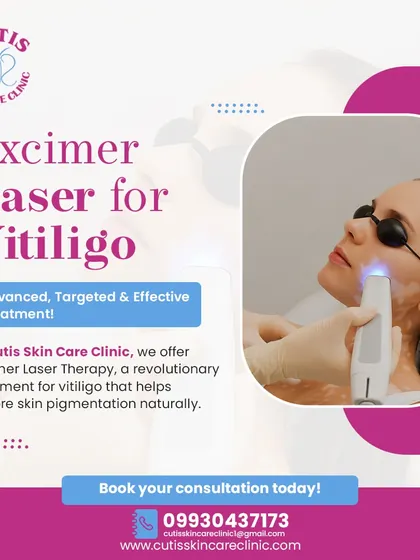 We use advanced technology like the Excimer Laser for targeted vitiligo treatment. This procedure safely stimulates repigmentation in affected areas, offering an effective, non-invasive solution for restoring your skin's natural color.