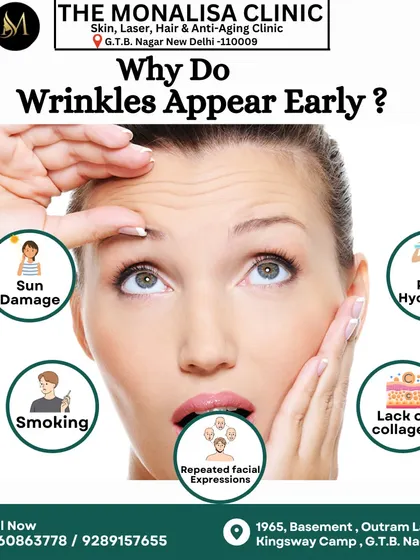 Wondering why wrinkles can appear early? This educational graphic identifies common culprits, including sun damage, smoking, poor hydration, lack of collagen, and repeated facial expressions.