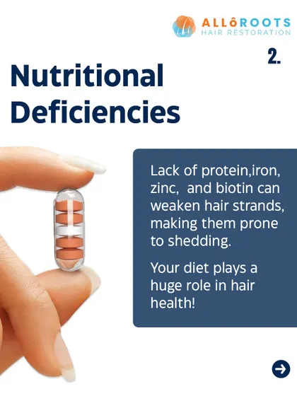 Nutritional deficiencies are a key reason for hair thinning. A lack of essential nutrients like protein, iron, zinc, and biotin directly weakens the hair structure, making it prone to shedding. Your diet is fundamental to your hair's health.