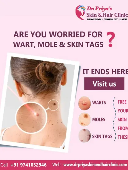 This graphic provides an overview of the common skin growths I treat, including warts, moles, and skin tags. My clinic offers specialized procedures for each of these conditions to restore clear, smooth skin safely.