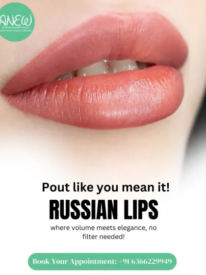 The Russian Lips technique is where volume meets elegance. It is designed to create a heart-shaped pout with more height and less projection, avoiding an overfilled look.