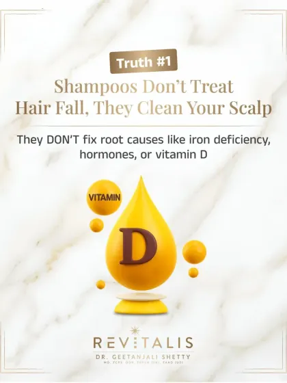 Here is the simple truth. Shampoos are designed to clean your scalp, not to treat hair fall. They cannot fix underlying root causes like an iron deficiency, hormonal imbalances, or low vitamin D levels.