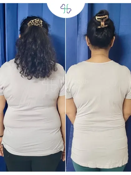 Back view of her 9 kg transformation. She looks stronger and more toned.