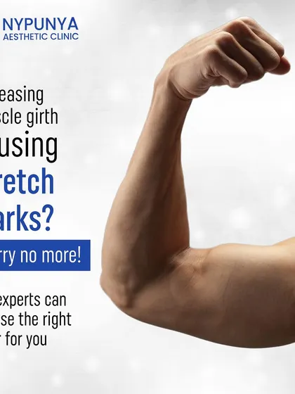 Seeing stretch marks from increasing muscle girth? Worry no more. Our experts can choose the right laser treatment to significantly reduce the appearance of stretch marks and give you smooth, mark-free skin.