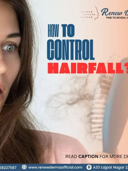 Wondering how to control hair fall? PRP therapy is a powerful solution. This treatment uses the concentrated platelets from your own blood to stimulate the scalp, improve circulation, and activate hair growth.