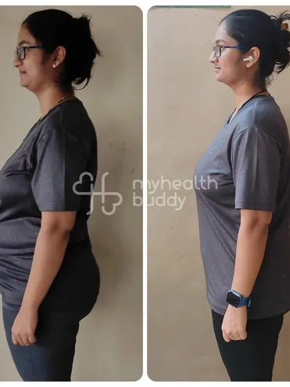 This client lost 11 kgs in 3 months post-pregnancy. Her journey started with small changes to her diet and beginner-friendly workouts, proving that simple steps lead to big results.