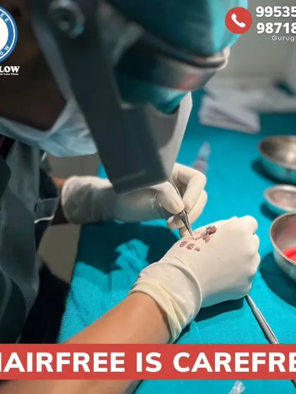 Here, individual hair grafts are being carefully prepared for transplantation. This delicate process is crucial for ensuring the viability of each follicle, which leads to higher success rates and denser hair growth.