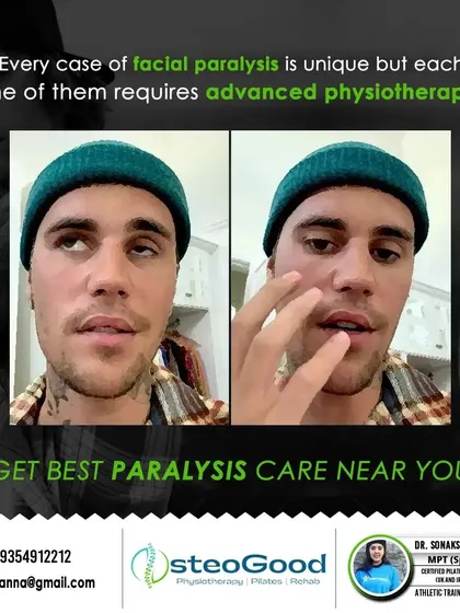 Facial paralysis, or Bell's Palsy, requires a very specific and gentle approach. I use advanced physiotherapy techniques to help patients regain facial muscle control, improve symmetry, and restore their confidence.